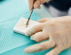 A dental practitioner scrapes amalgam onto a dental mixing pad for usage