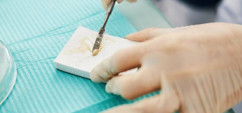 A dental practitioner scrapes amalgam onto a dental mixing pad for usage